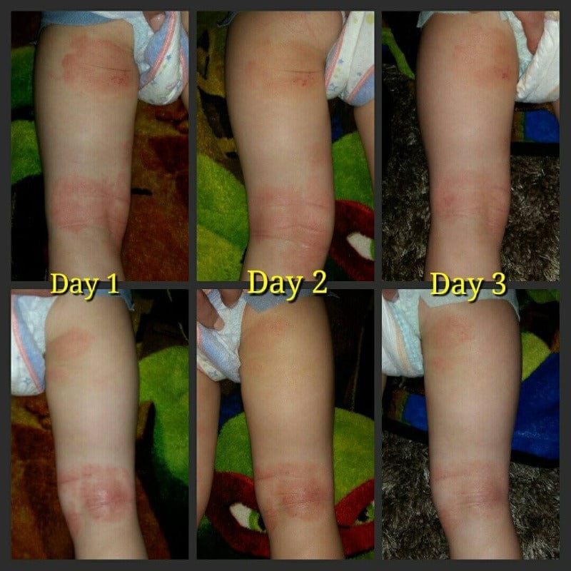 Soothe My Skin Rejuvenation Cream
