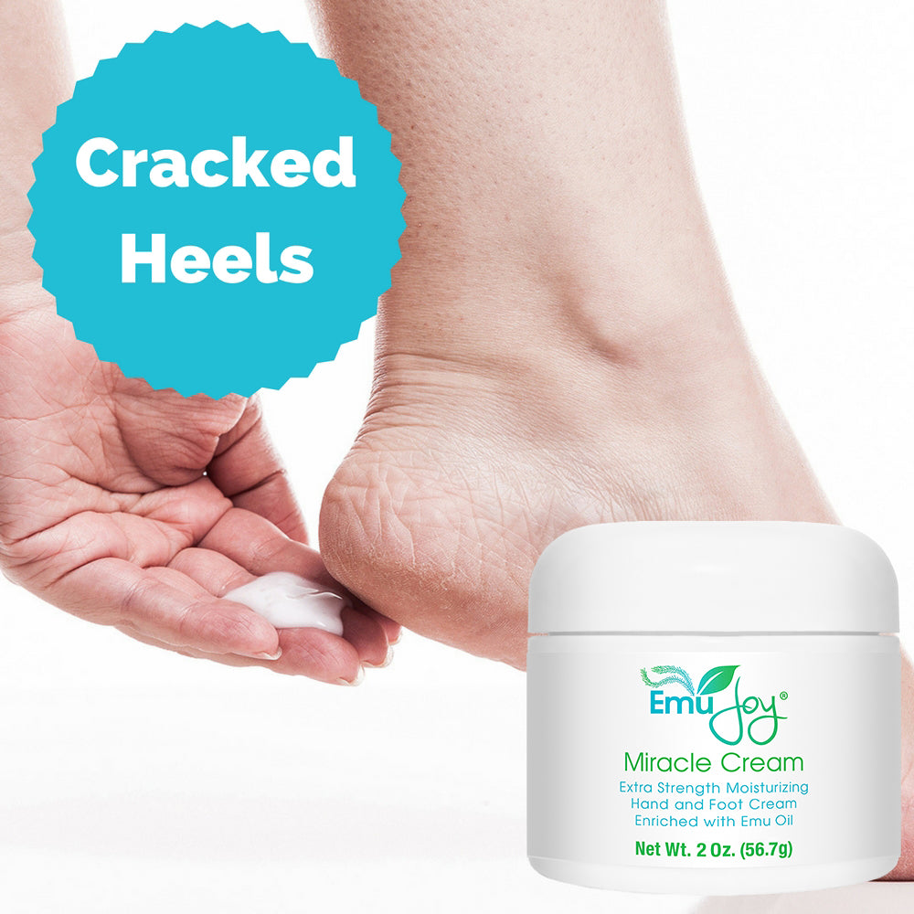 Miracle Cream